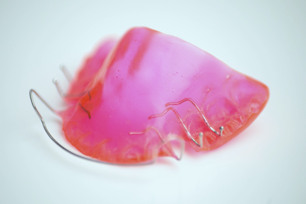 Herausnehmbare Zahnspangen