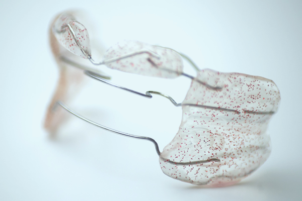 Herausnehmbare Zahnspangen