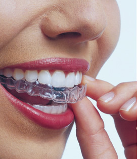 Invisalign®