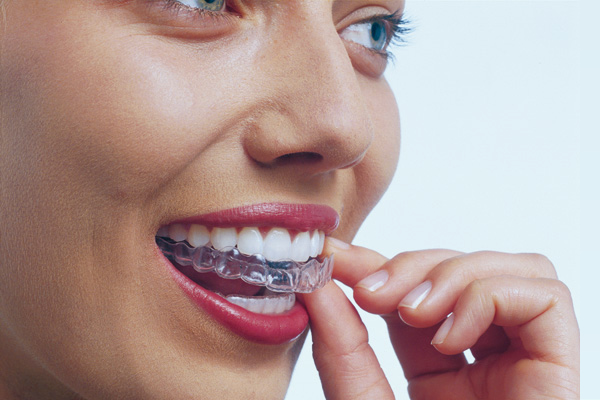 Invisalign®